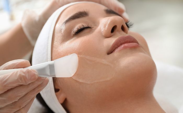 peeling chemiczny
